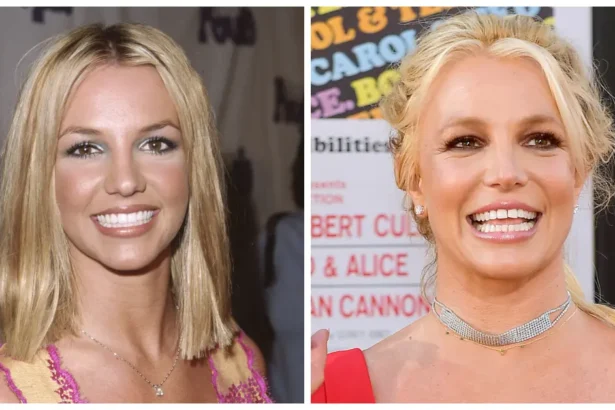 britney spears teeth